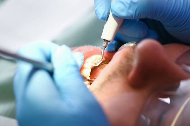 Best Pediatric Emergency Dentist in Harbour Heights, FL